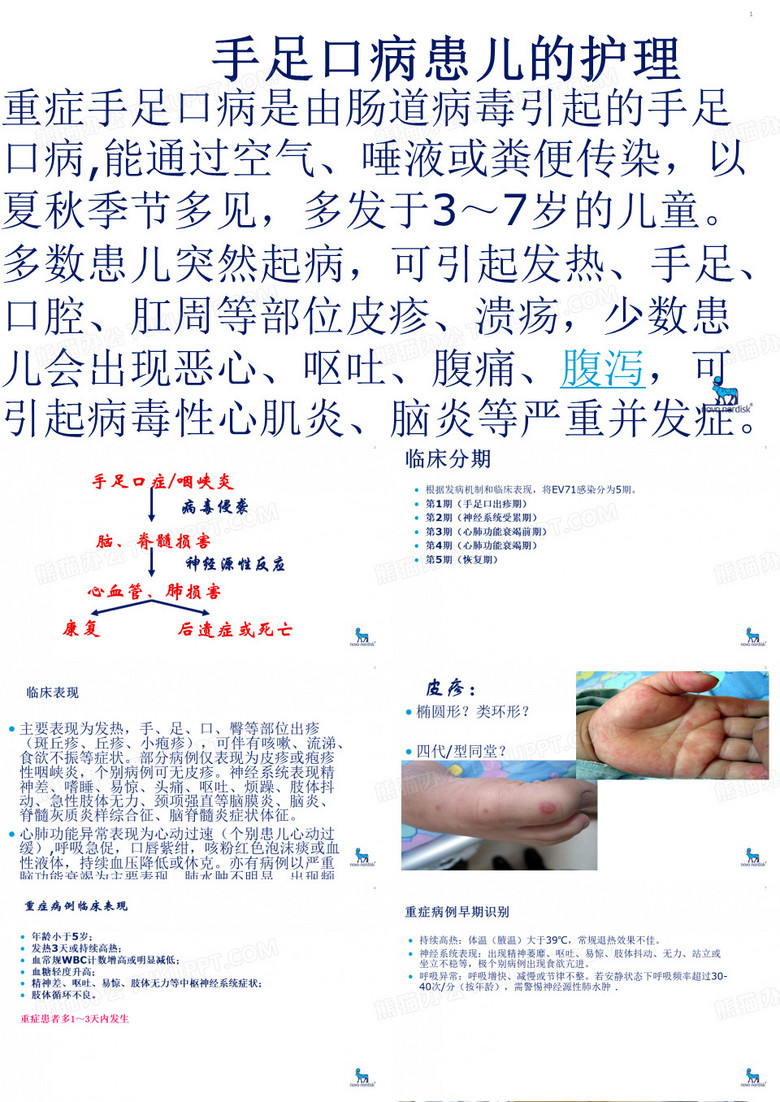 重症手足口病护理
