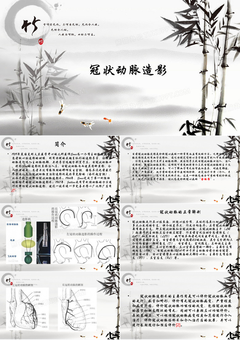 冠状动脉造影
