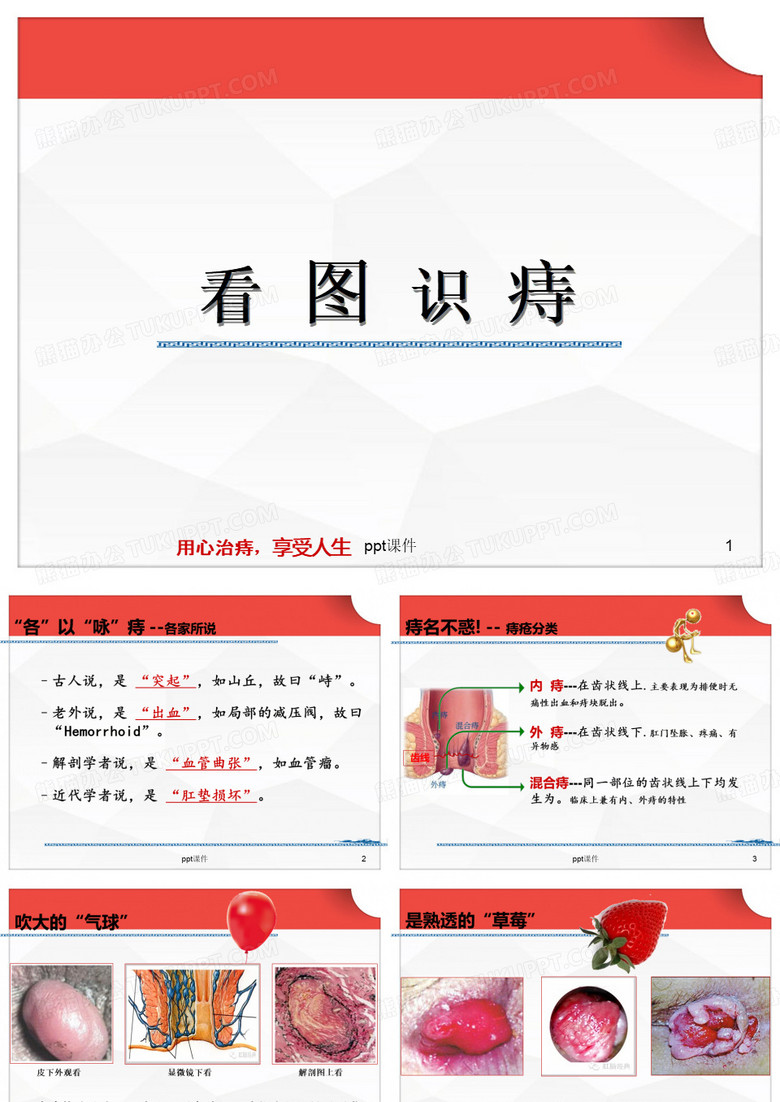 图说痔疮  ppt课件