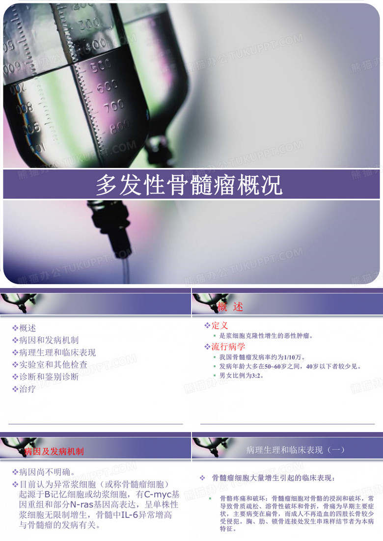 多发性骨髓瘤