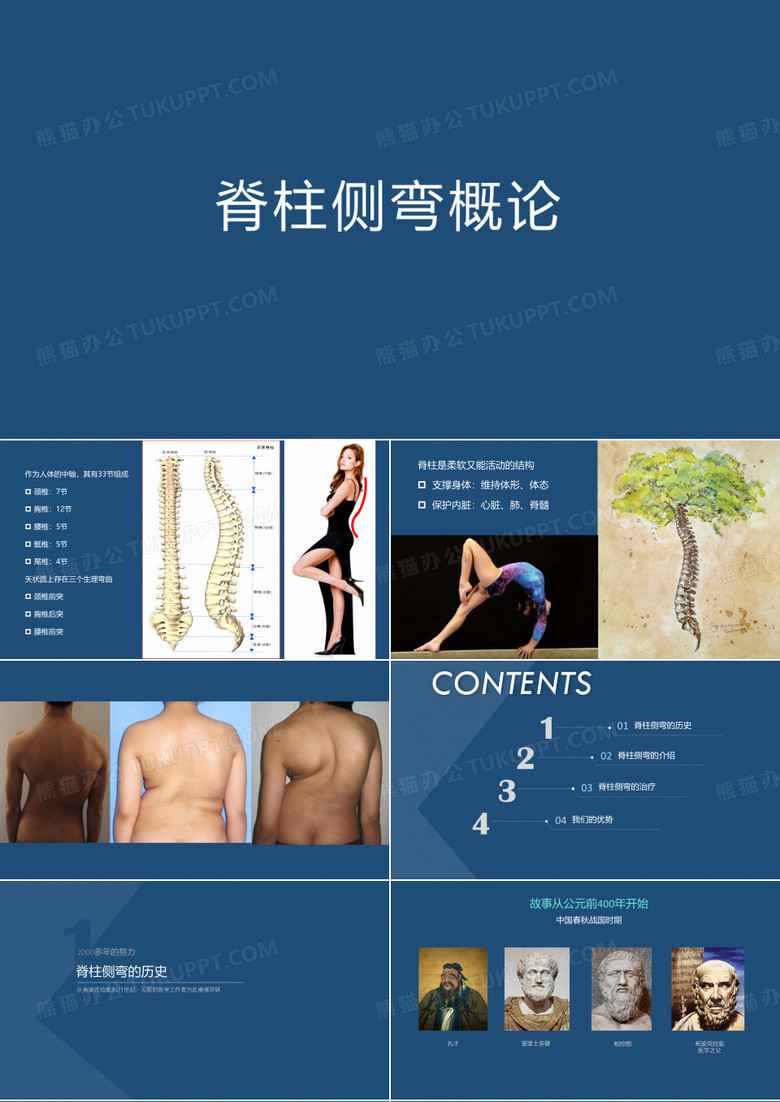 脊柱侧弯概论