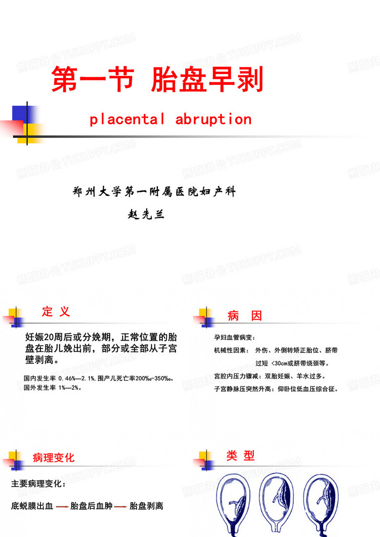 胎盘早剥
