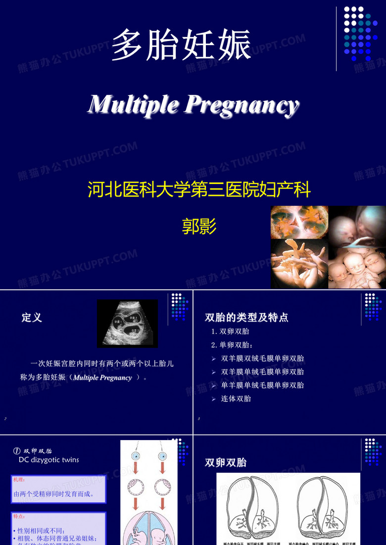 多胎妊娠2017