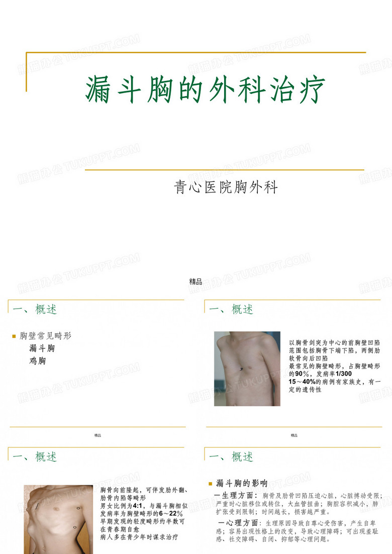 漏斗胸的外科治疗