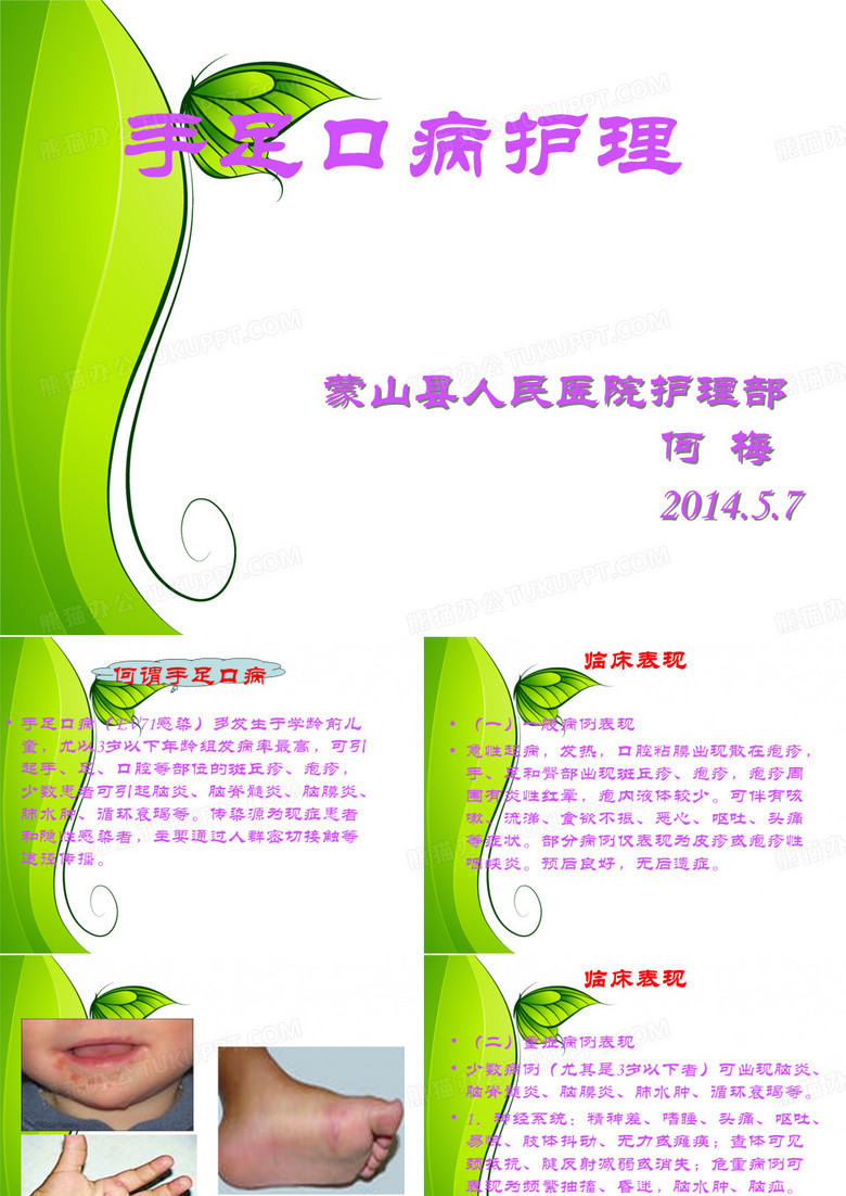 手足口病护理