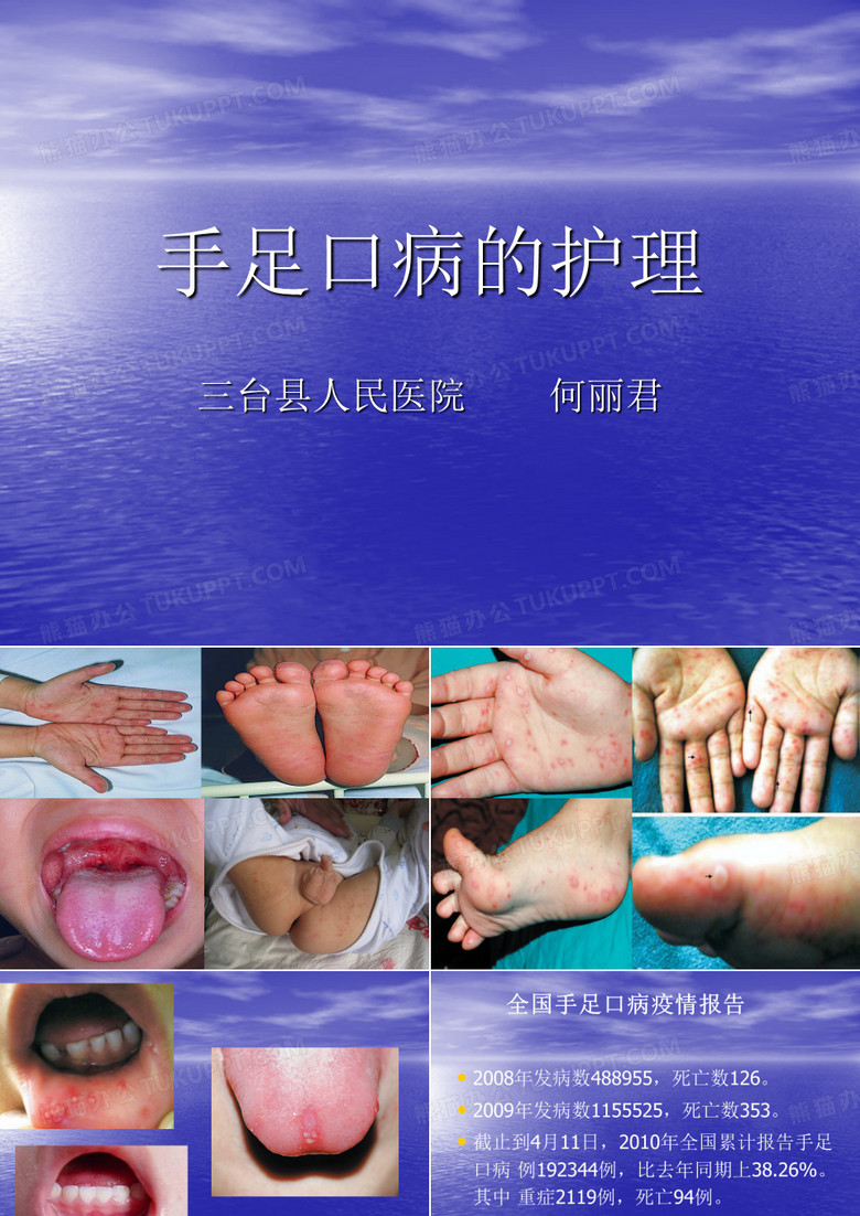 手足口病的护理