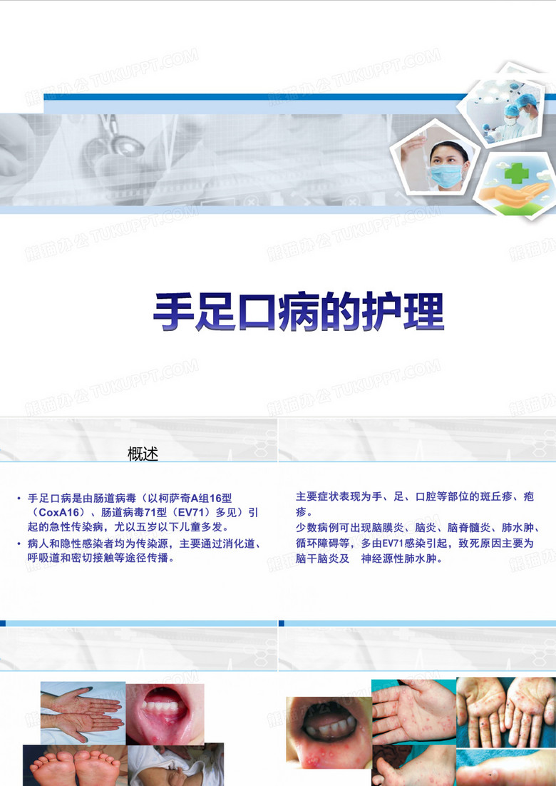手足口病的护理