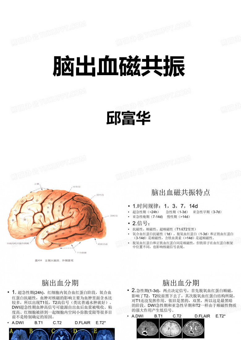 脑出血磁共振
