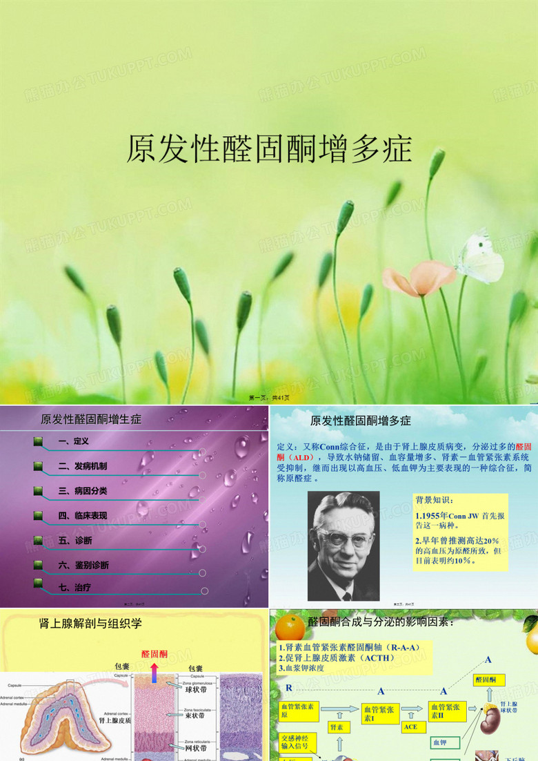 原发性醛固酮增多症