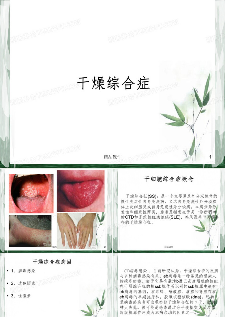干燥综合症