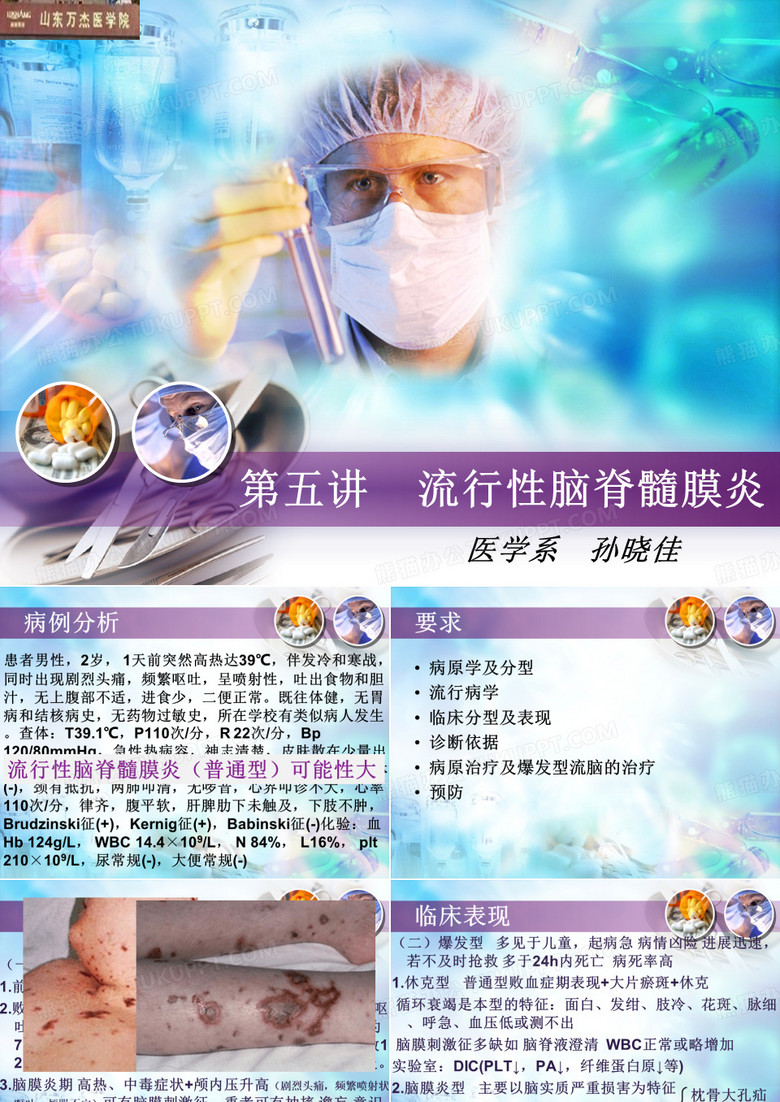 流行性脑脊髓膜炎