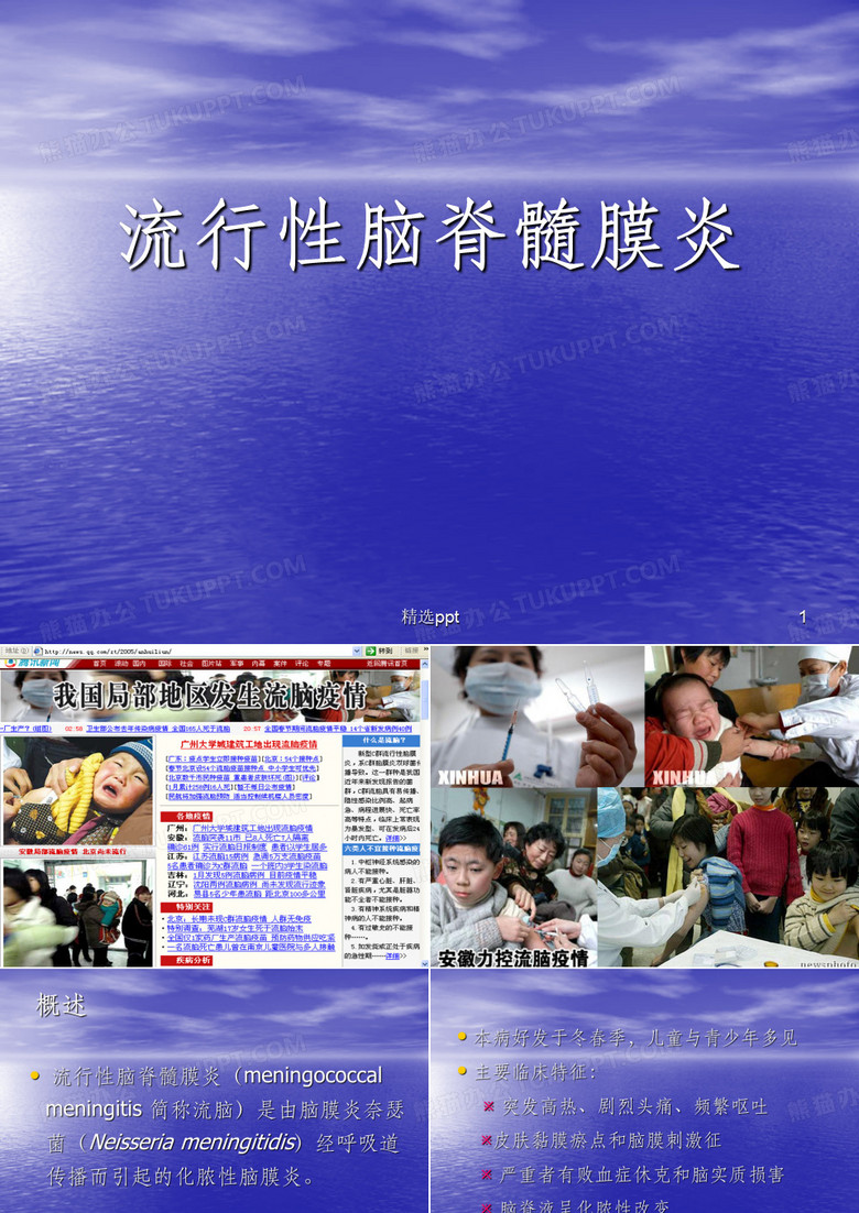 流行性脑脊髓膜炎