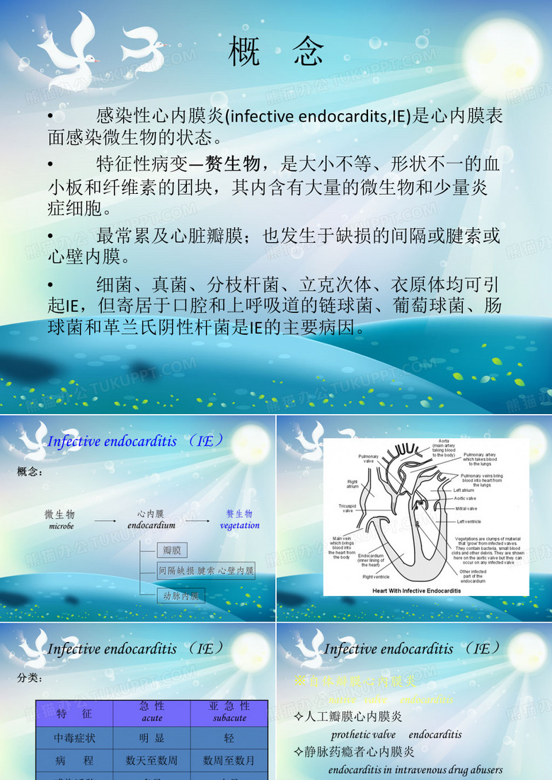 感染性心内膜炎