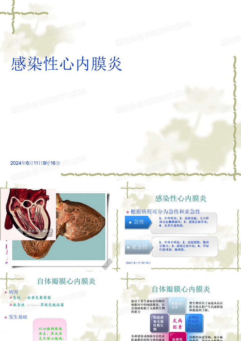 感染性心内膜炎