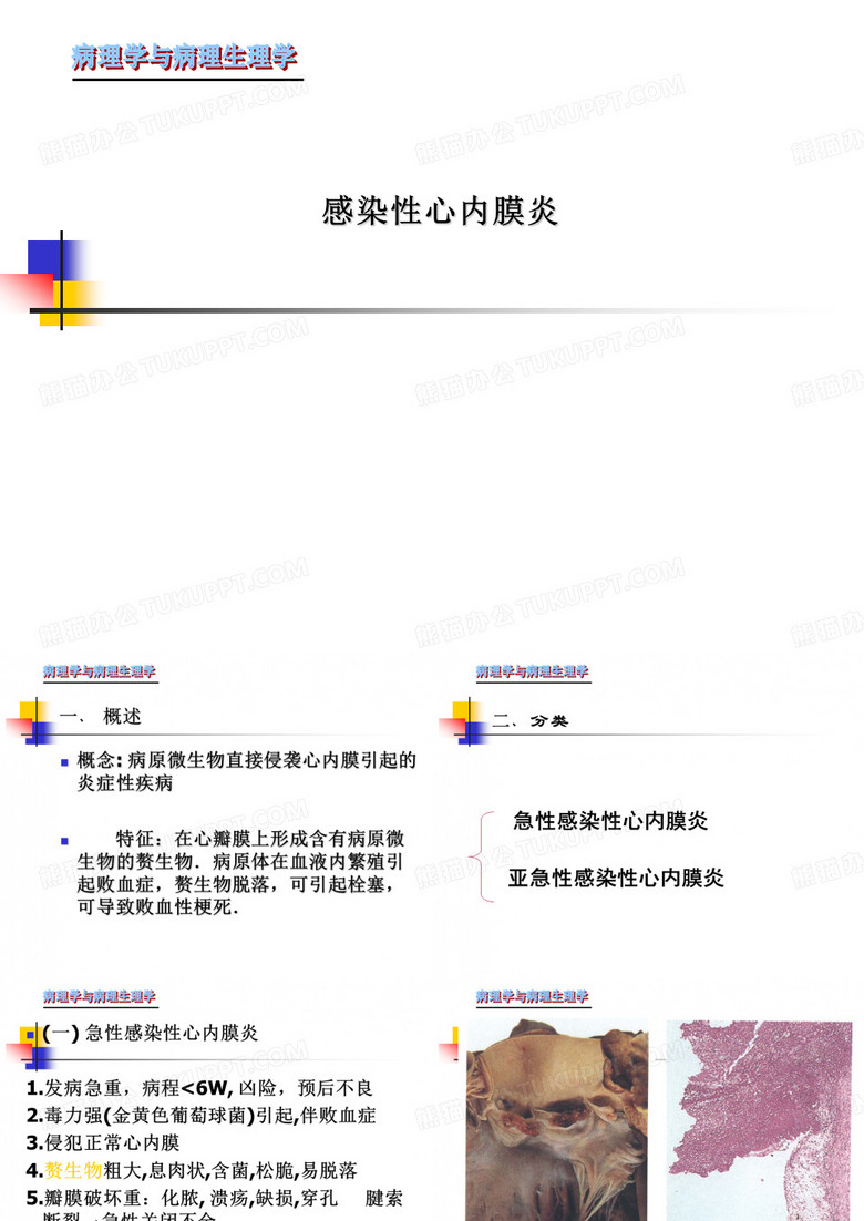 感染性心内膜炎