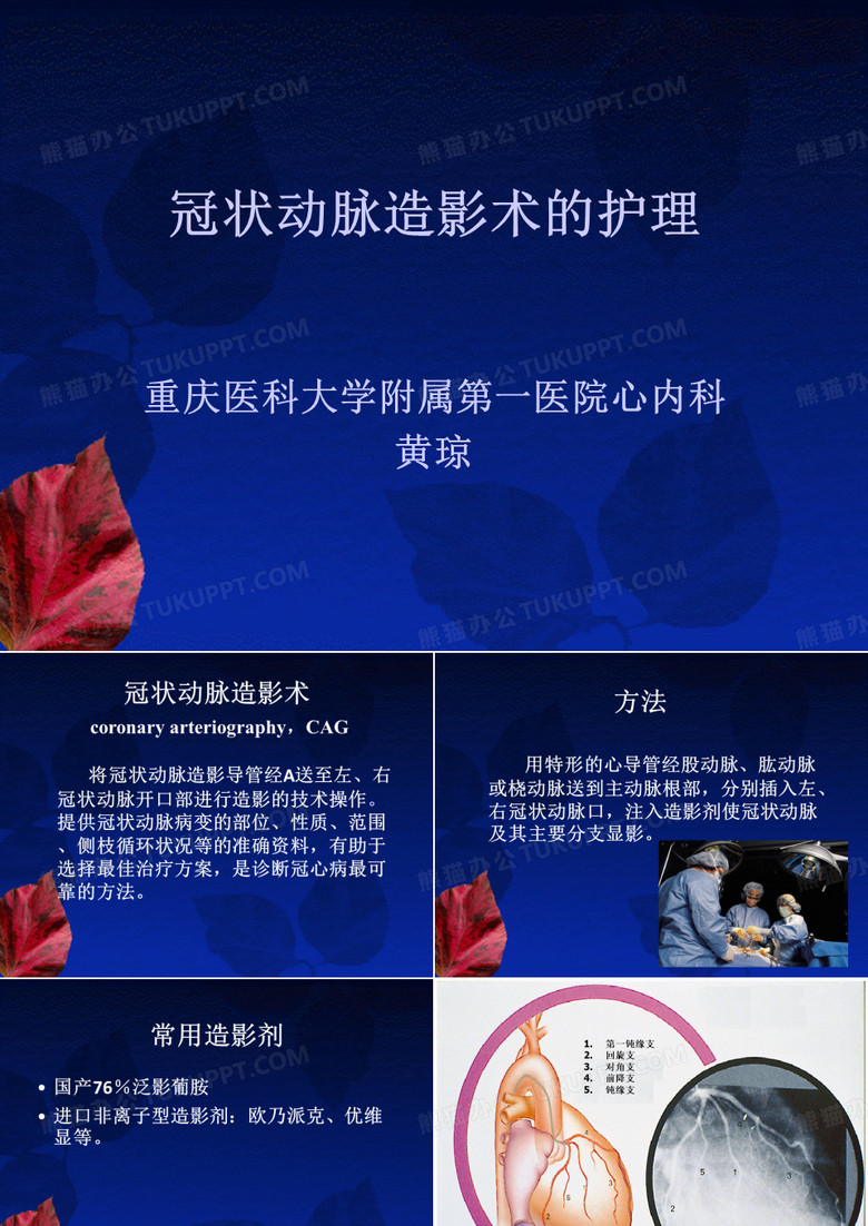 冠状动脉造影术的护理完整