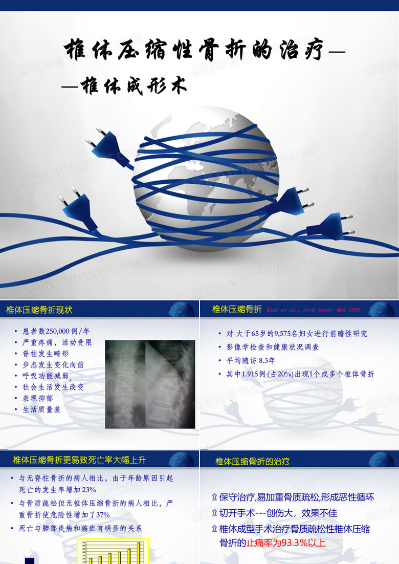 椎体压缩性骨折的治疗——椎体成形术