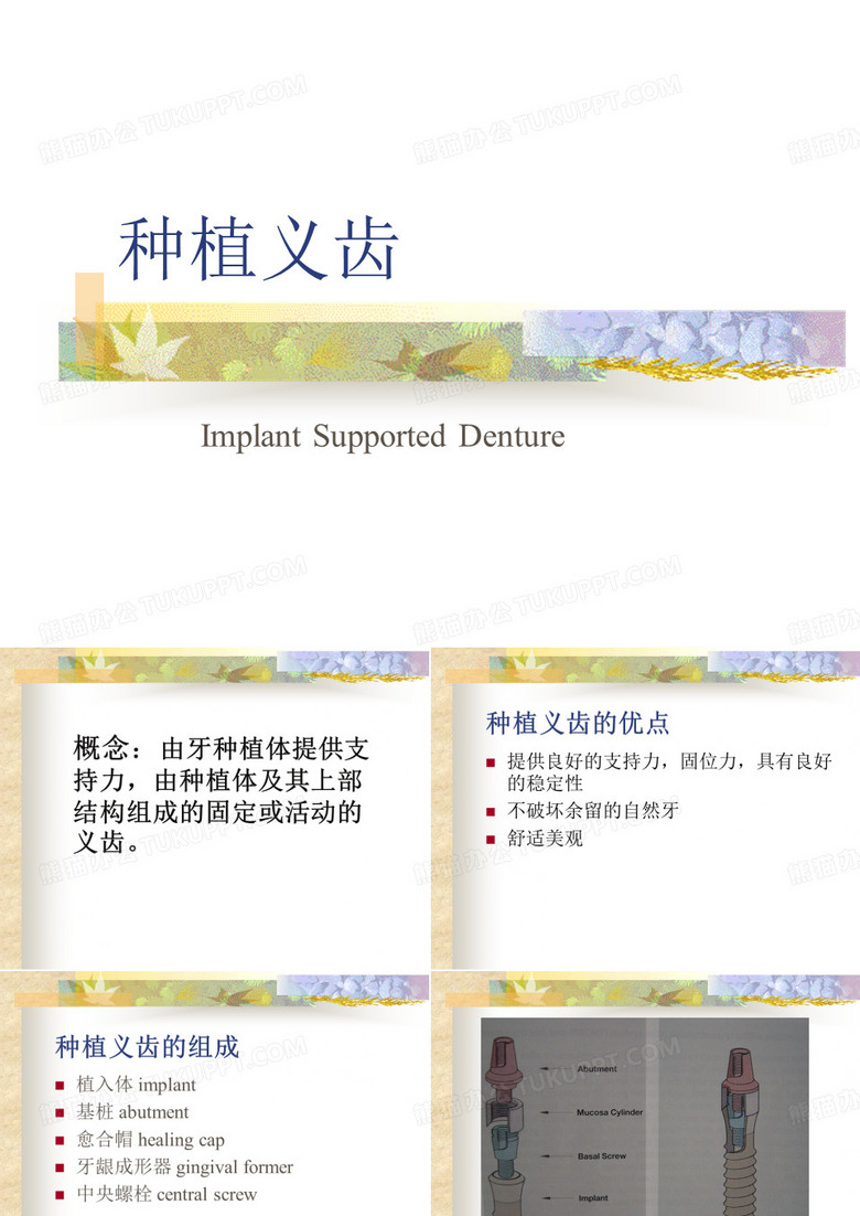 种植义齿