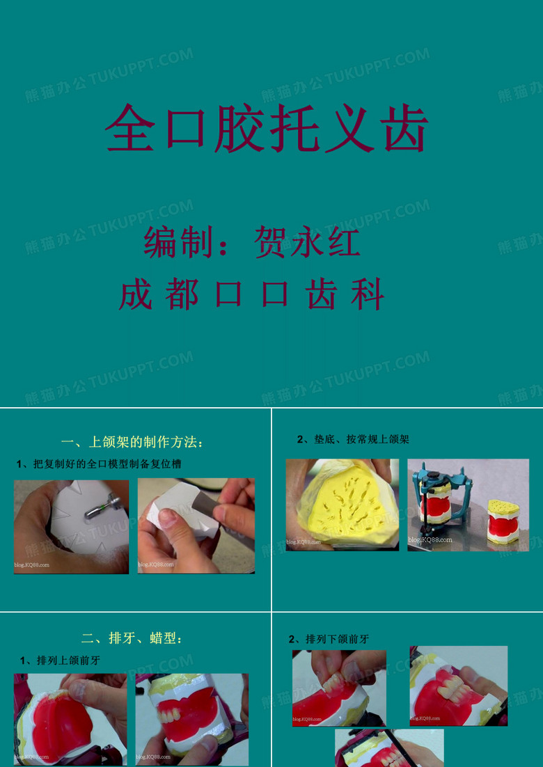 全口胶托义齿