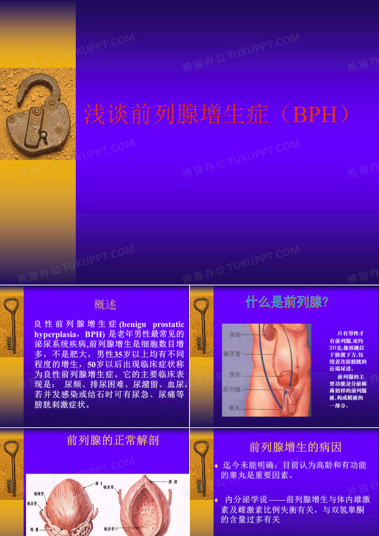 前列腺增生症