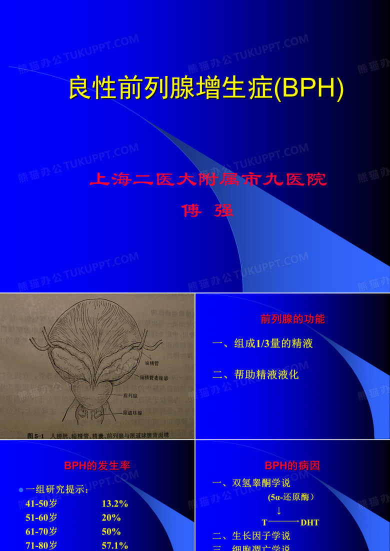 良性前列腺增生症BPH