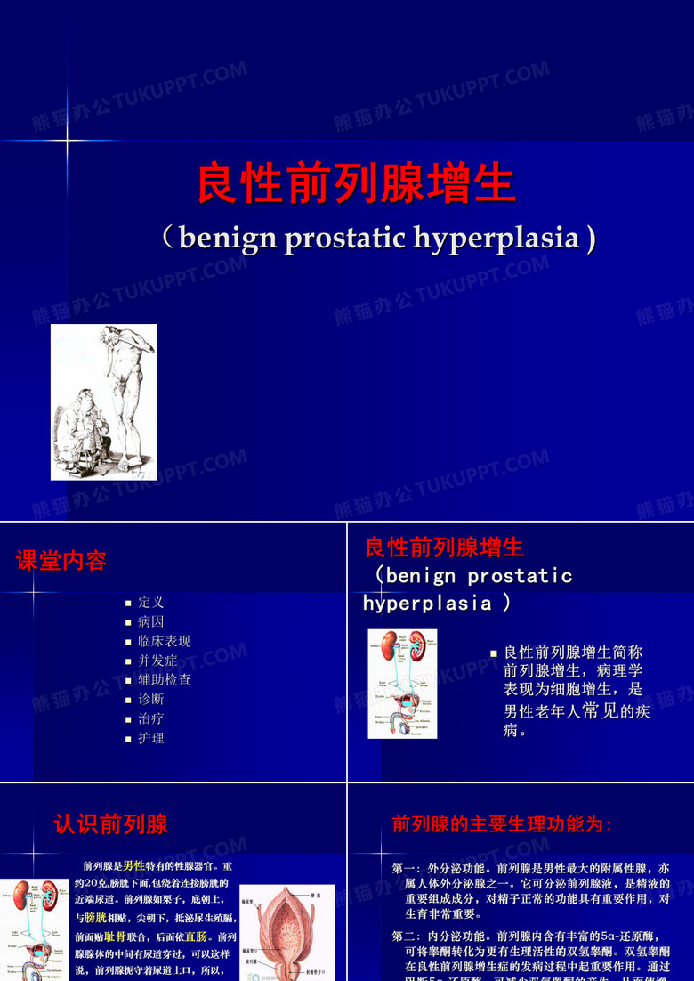 讲课良性前列腺增生症