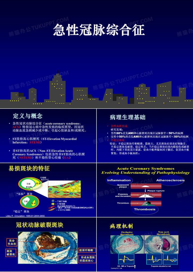 急性冠脉综合征