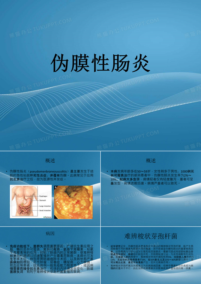 伪膜性肠炎.
