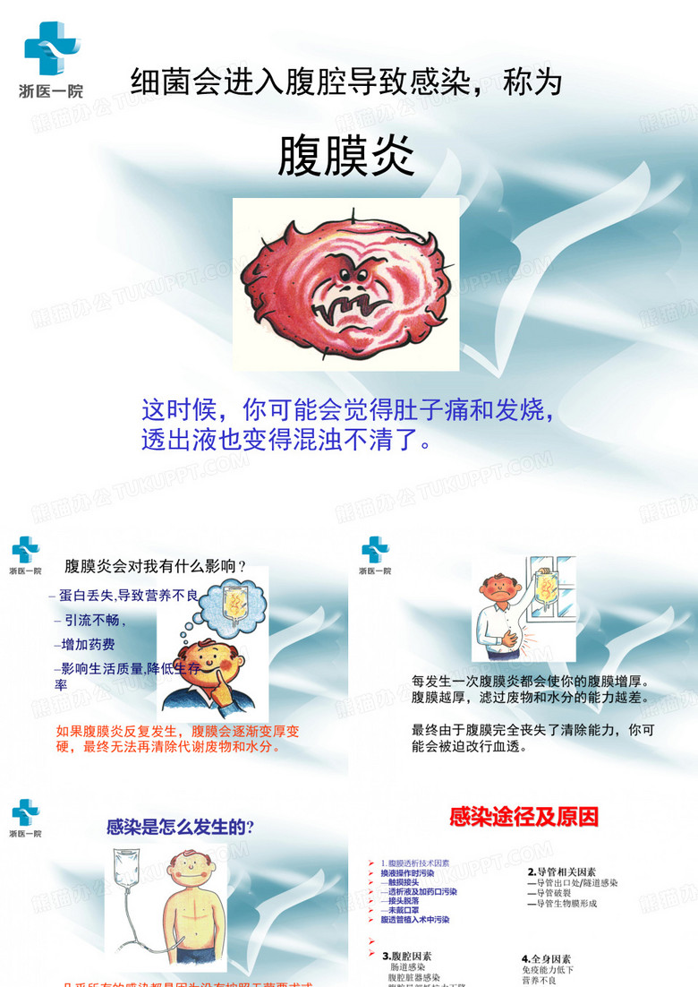 腹膜炎