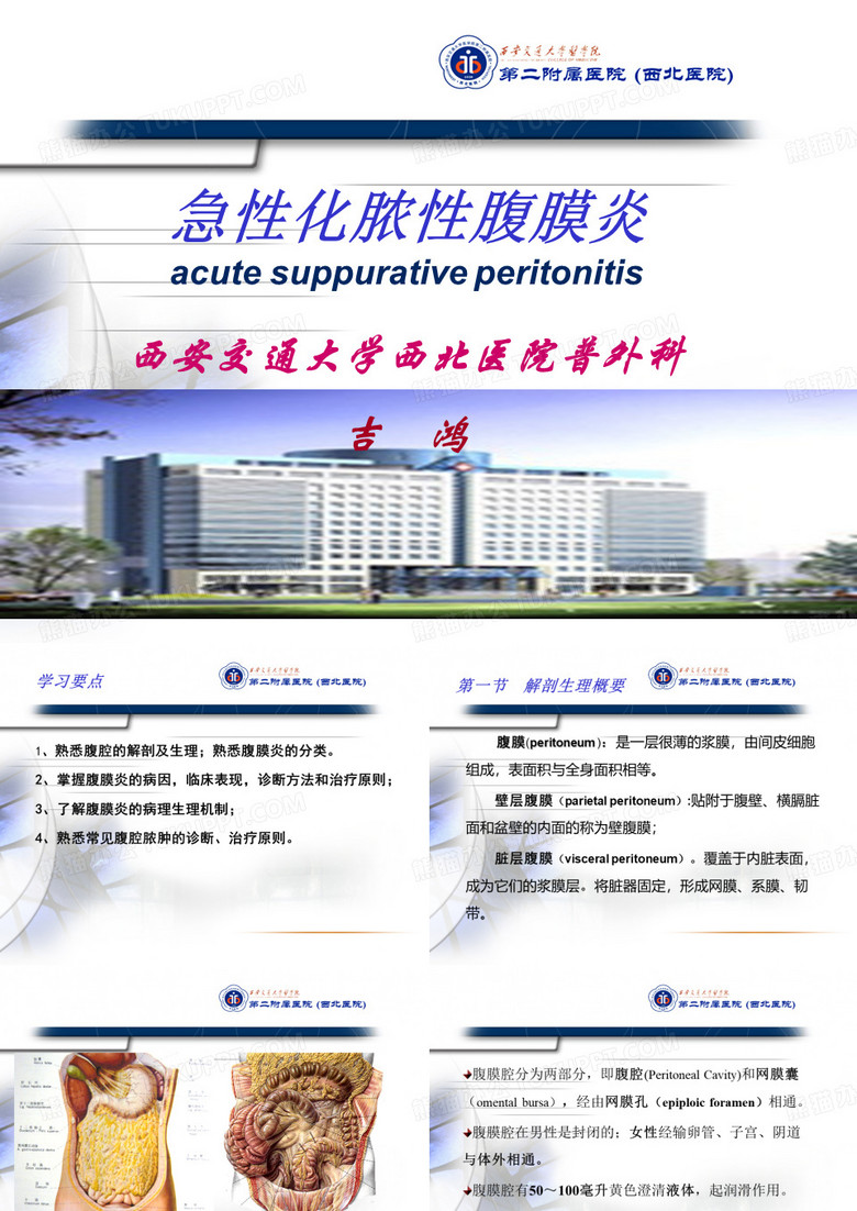 腹膜炎