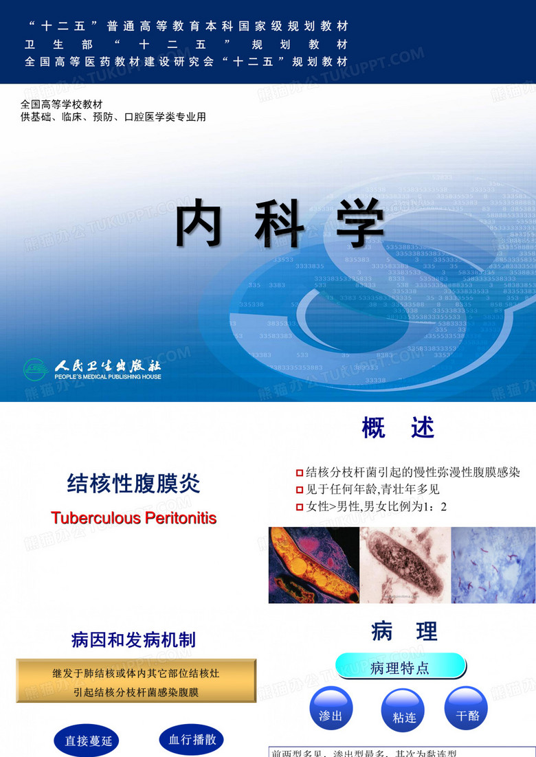 结核性腹膜炎