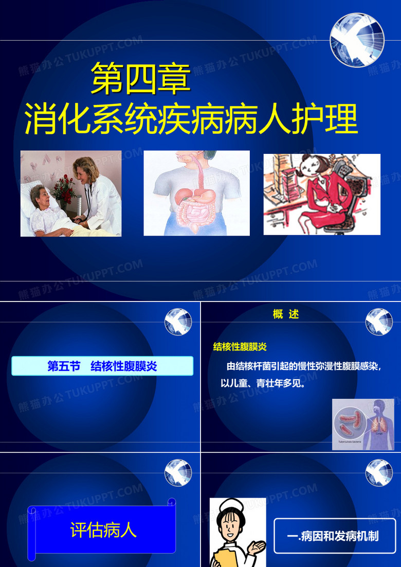 结核性腹膜炎