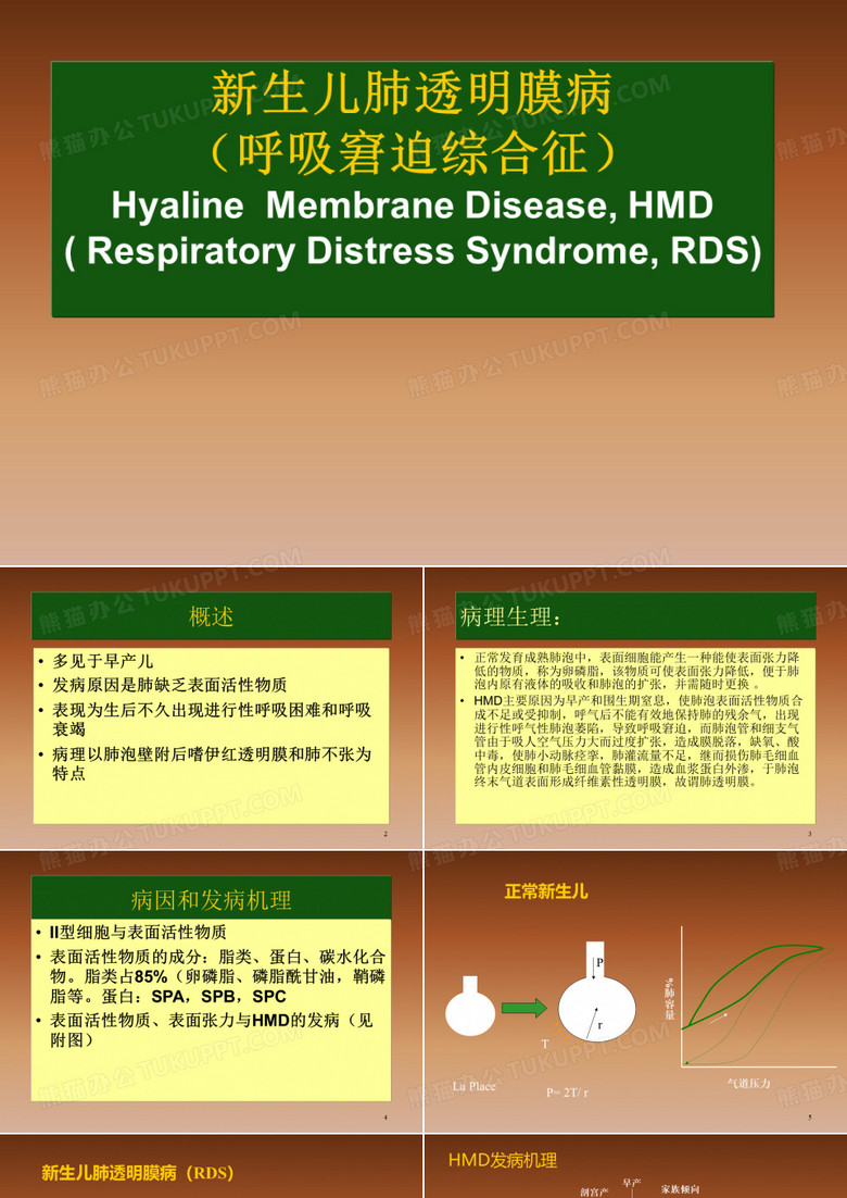 新生儿肺透明膜病(HMD)