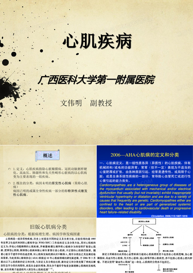 心肌病