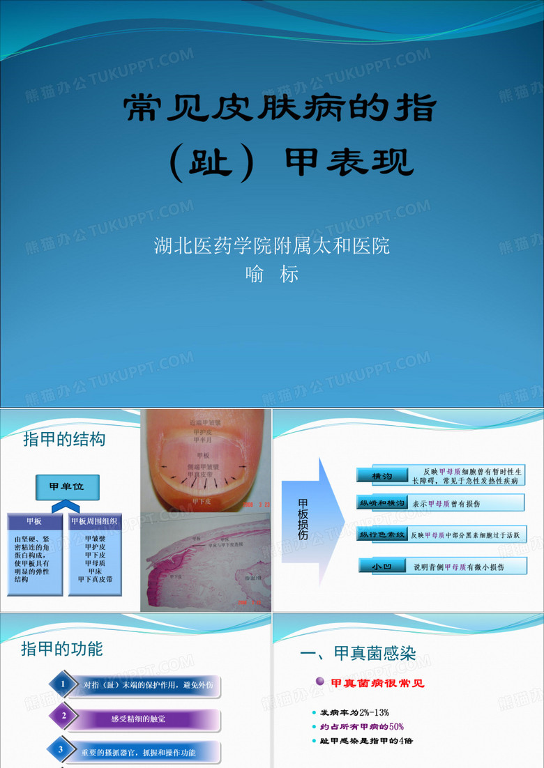 常见皮肤病的指甲表现