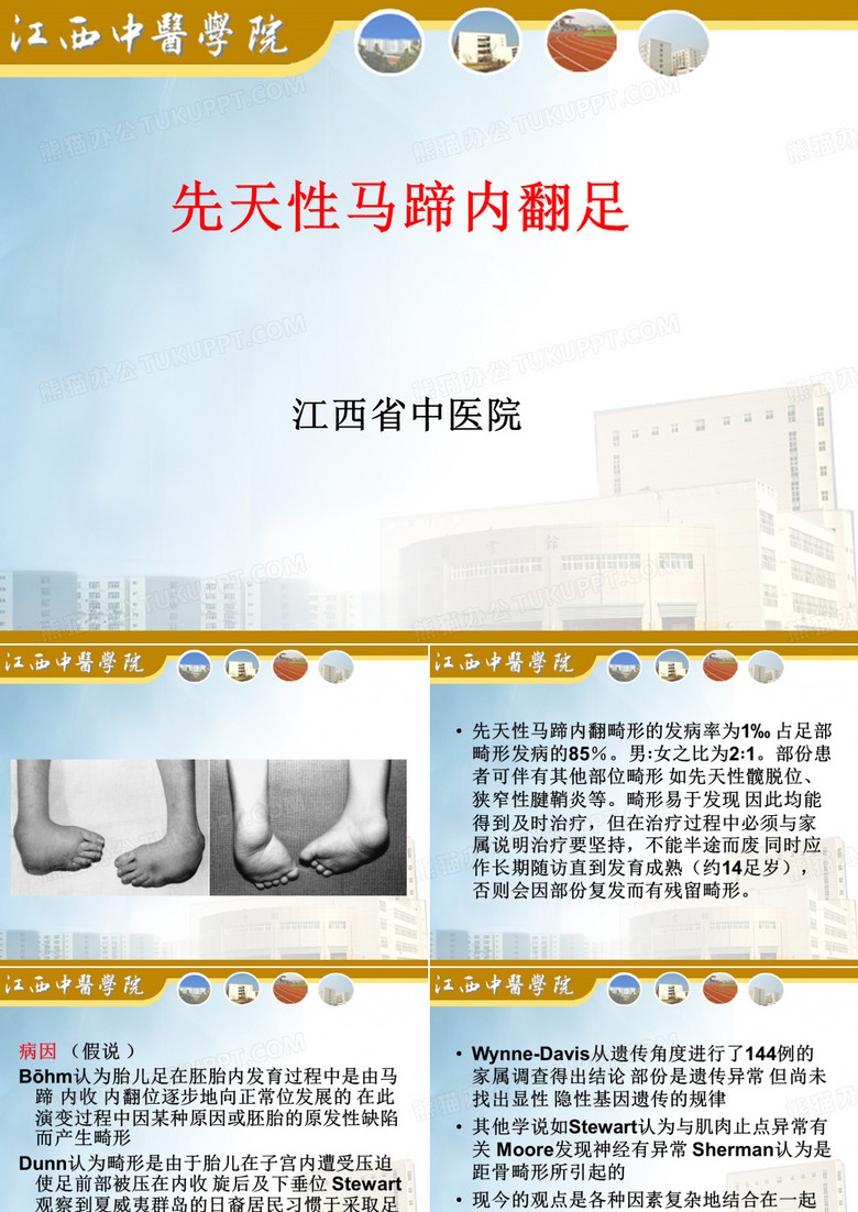 马蹄形内翻足