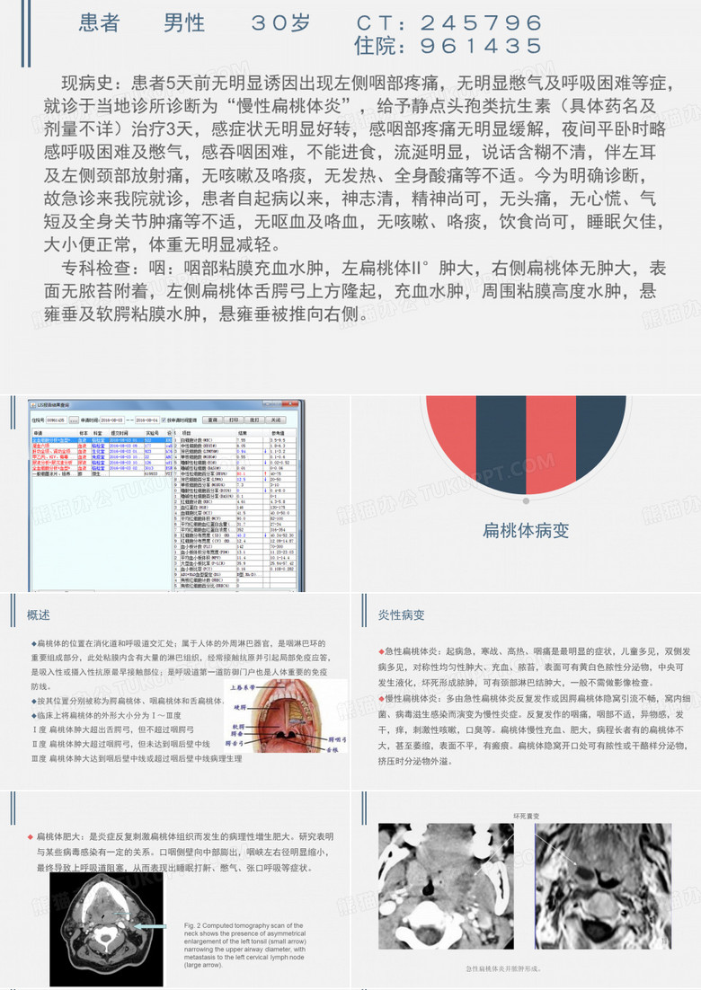 扁桃体病变