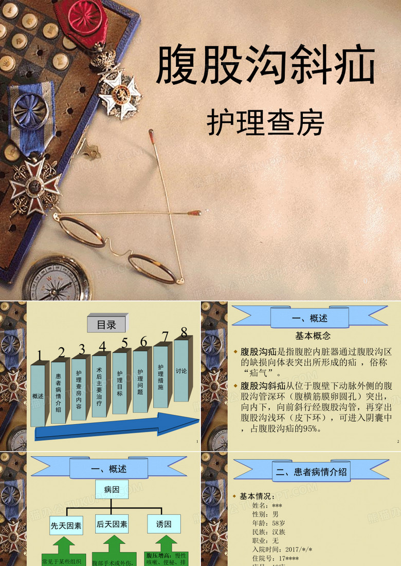 精选腹股沟斜疝护理查房
