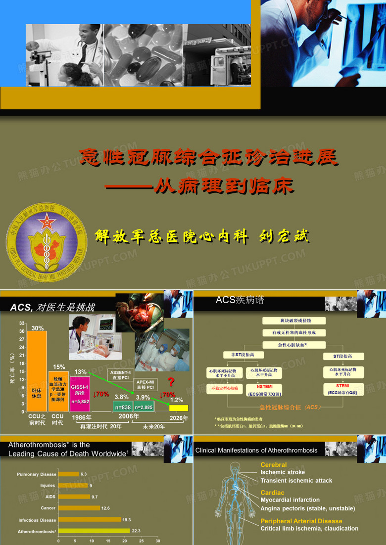 急性冠脉综合征