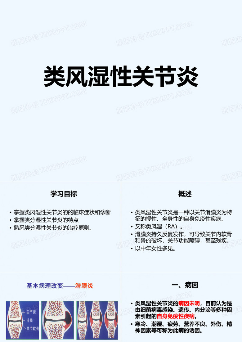 类风湿性关节炎