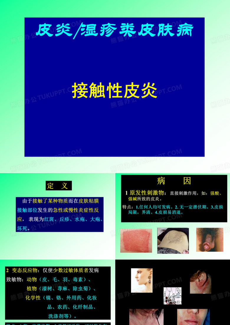 接触性皮炎、湿疹
