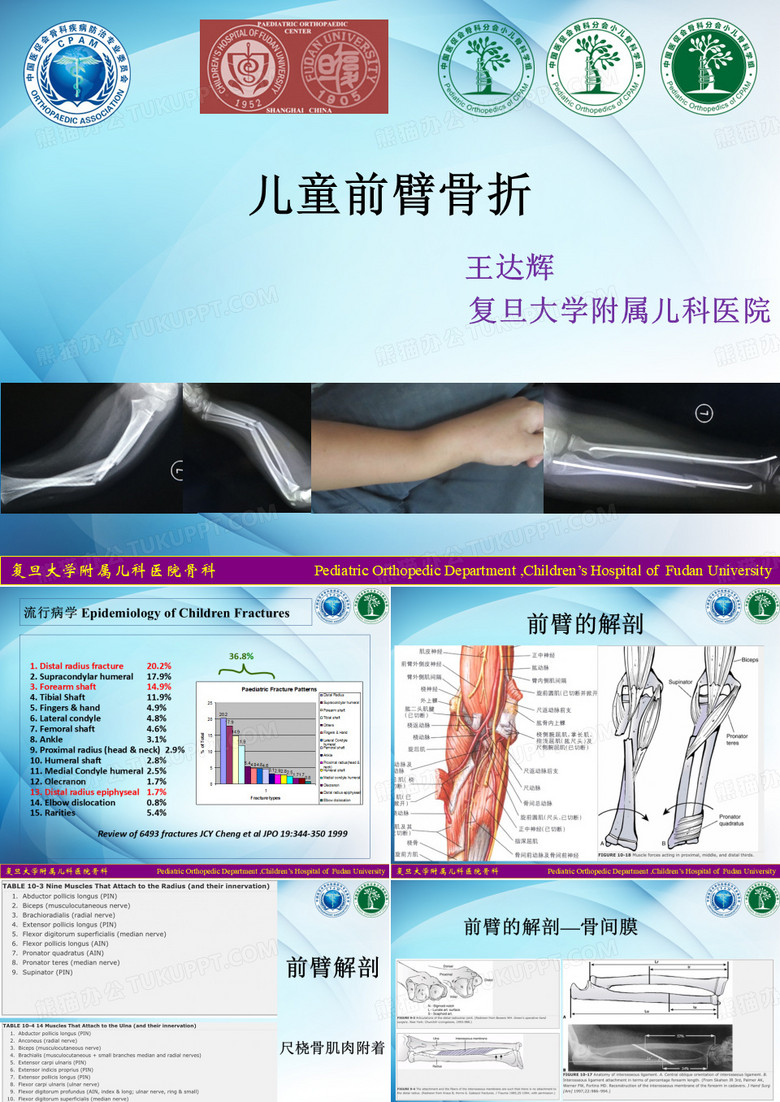 儿童前臂骨折