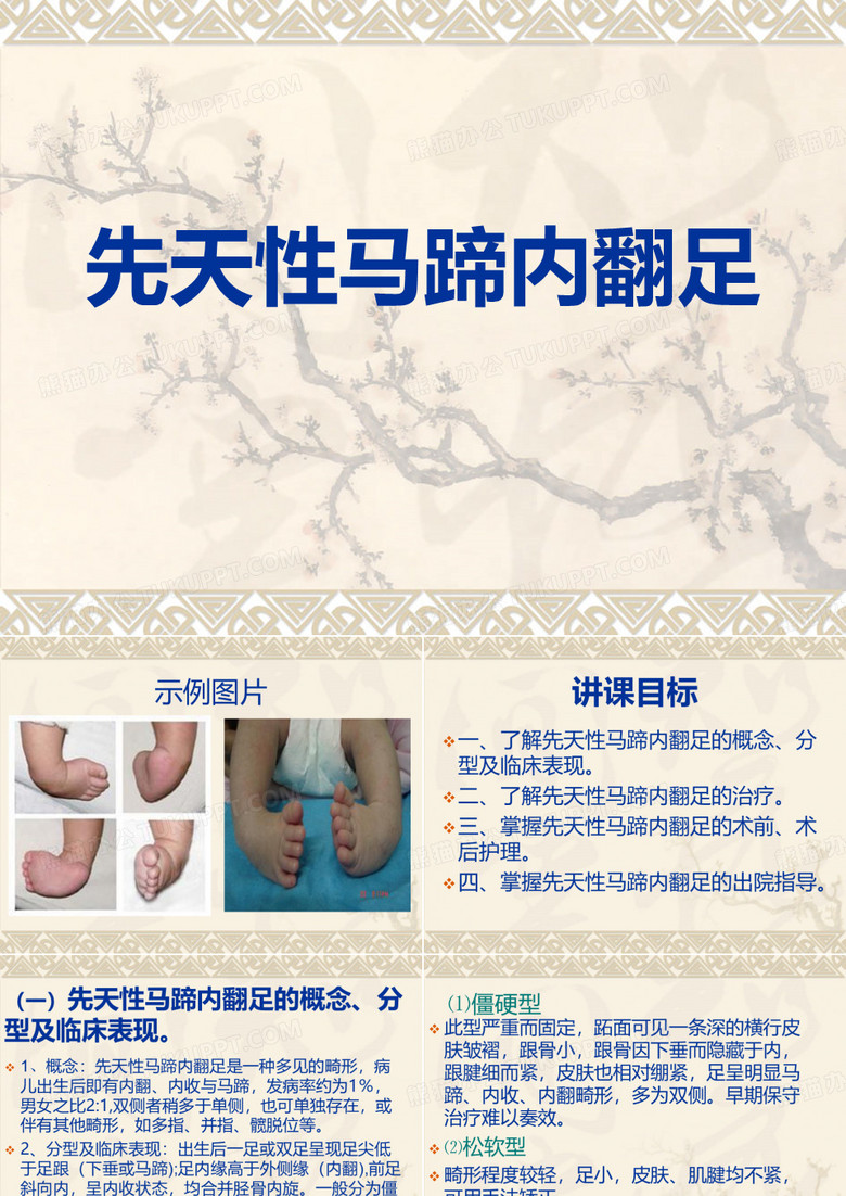 先天性马蹄内翻足