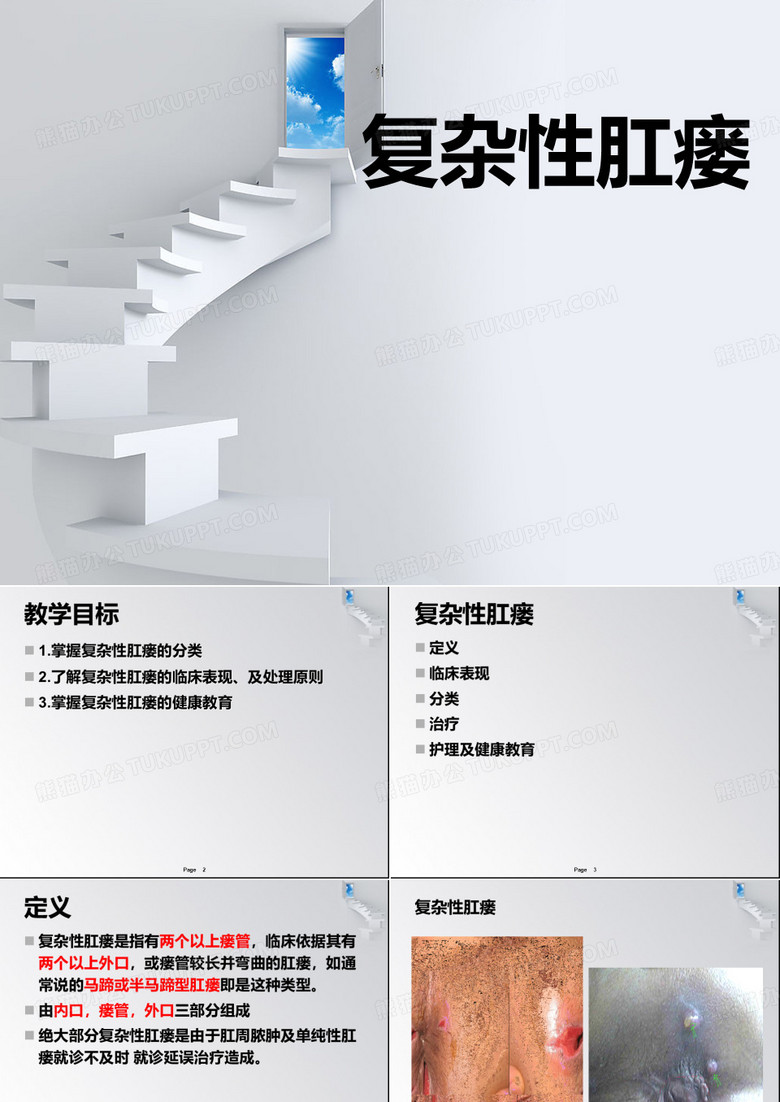 复杂性肛瘘