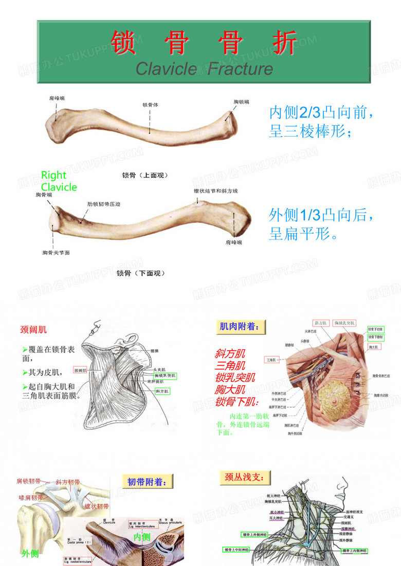 锁骨骨折幻灯片