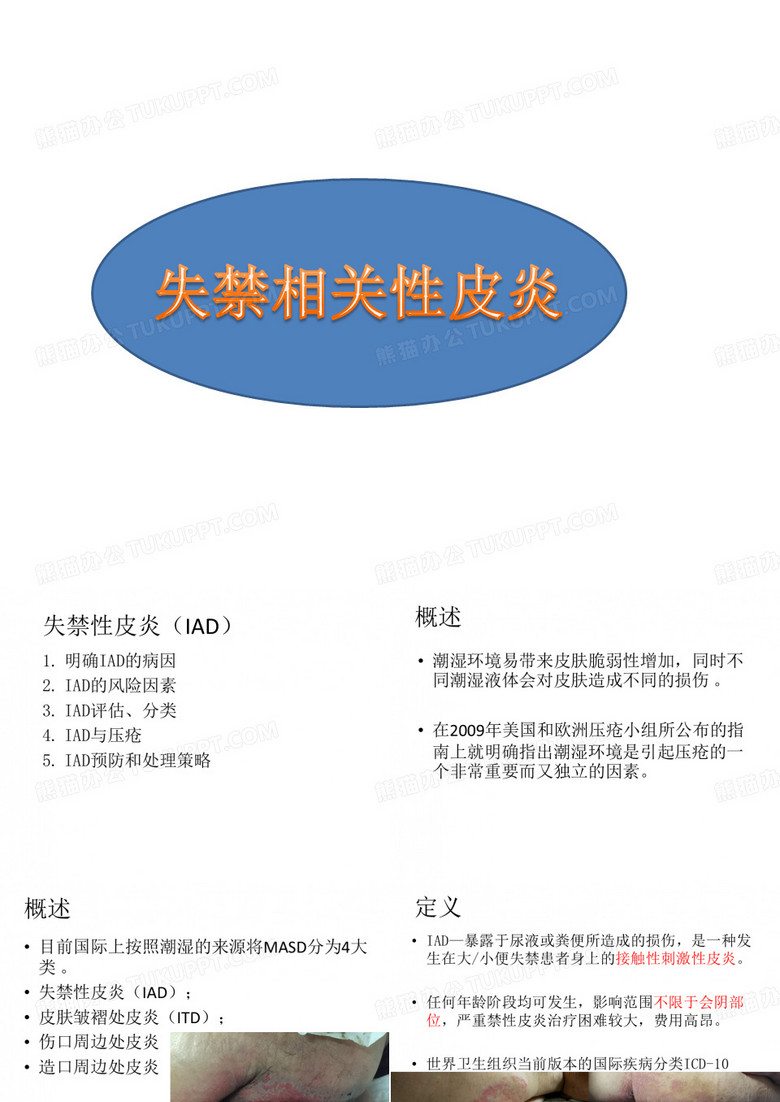 失禁性皮炎