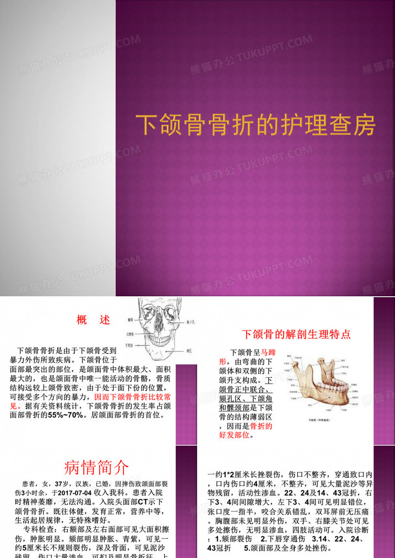 下颌骨骨折的护理查房