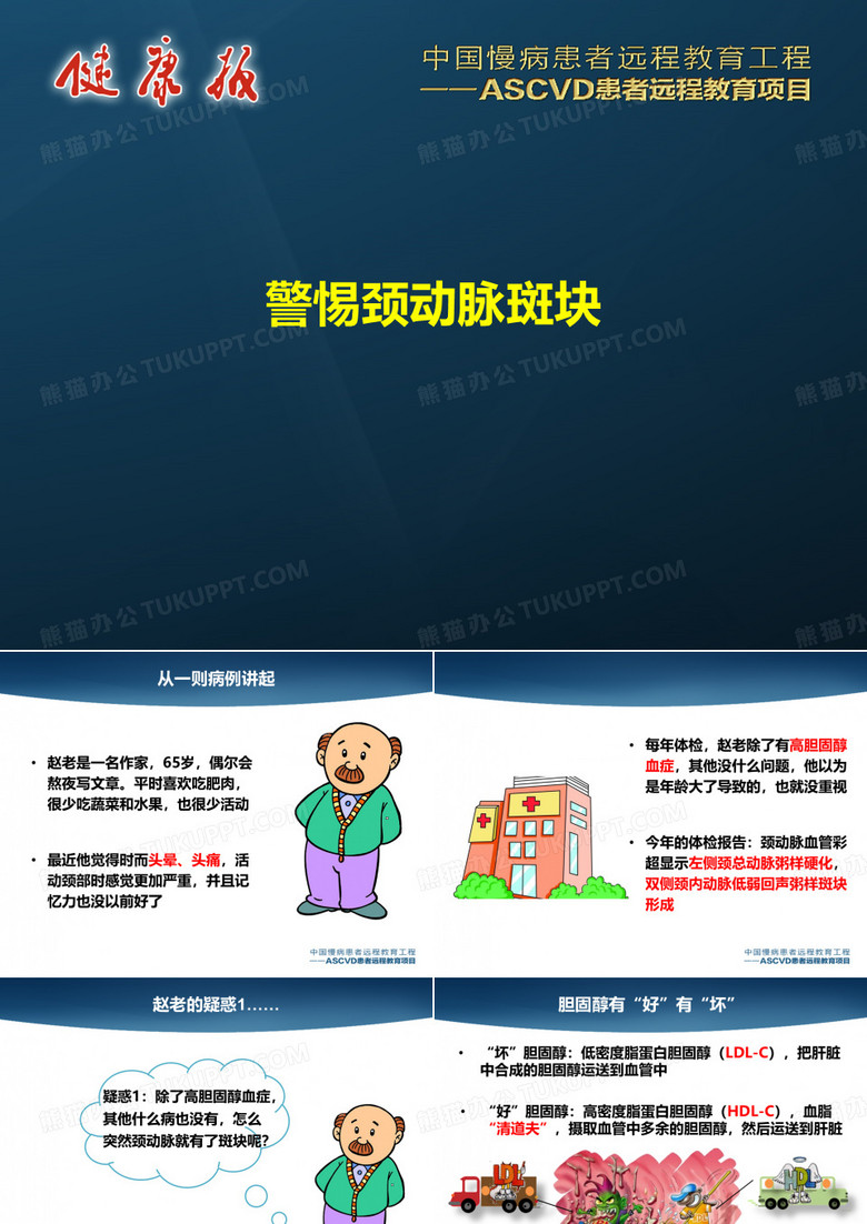 警惕颈动脉斑块