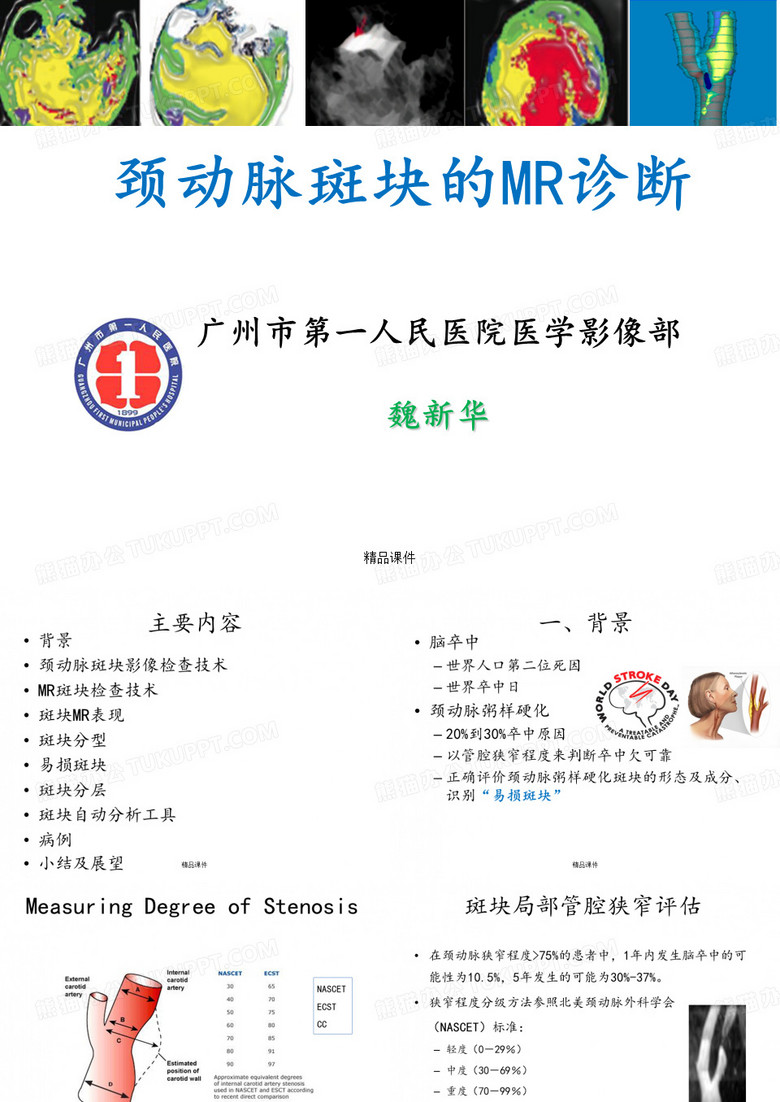 颈动脉斑块的MR诊断