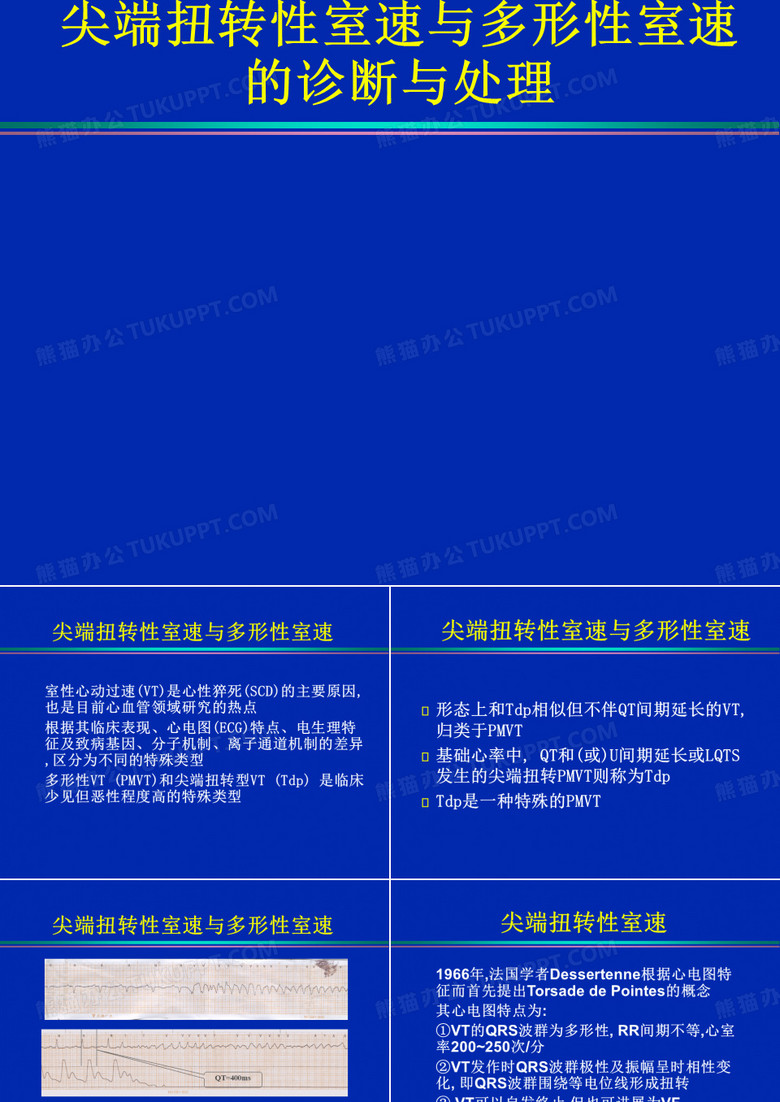 多形性室速与尖端扭转室速